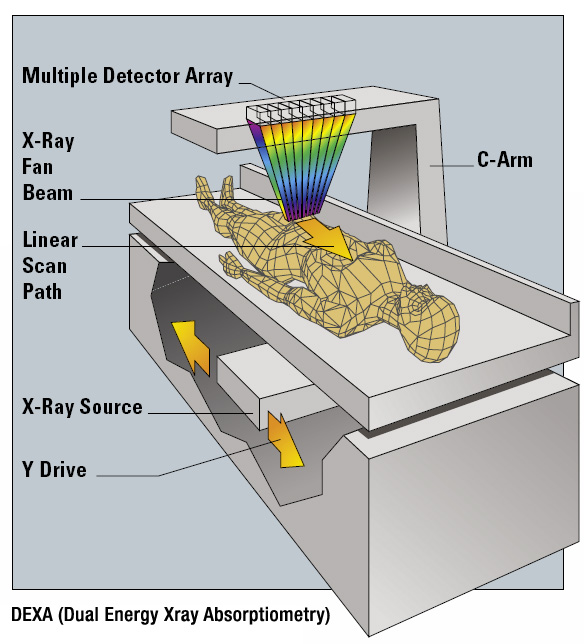 DEXA Scan, DXA Scan, Measure Bone Density & Body Fat