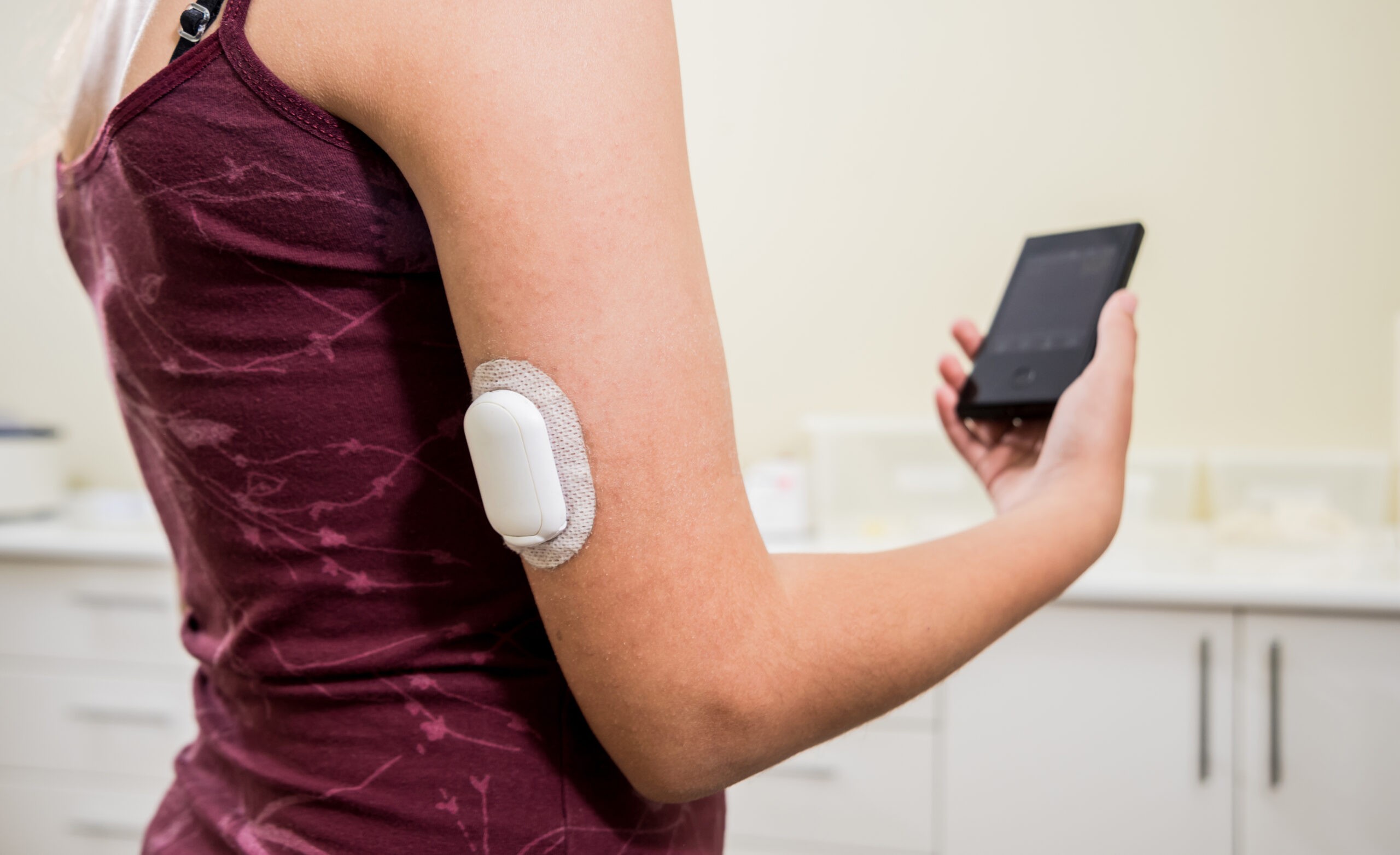 Exercise Doesn’t Change 24h Glucose Response Measured with CGM